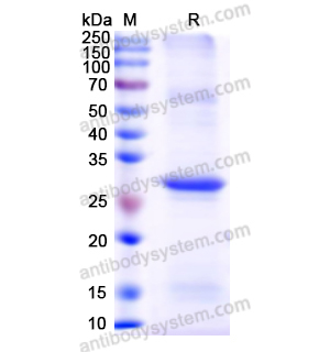 重組AR蛋白,Recombinant Human AR, N-His