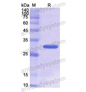 重组ARAF蛋白,Recombinant Human ARAF, N-His