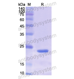 重组PTPRF蛋白,Recombinant Human PTPRF, N-His