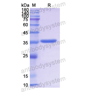 重组COX5B蛋白,Recombinant Human COX5B, N-GST