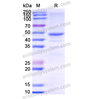 重组CTSA蛋白,Recombinant Human CTSA, N-GST