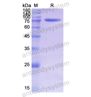 重組MAPT/Tau/PHF-tau蛋白,Recombinant Human MAPT/Tau/PHF-tau, C-His