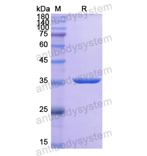 重组ALPG蛋白,Recombinant Human ALPG, N-His