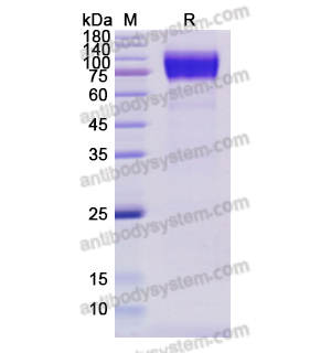 重組CD117/KIT蛋白,Recombinant Human CD117/KIT, C-His