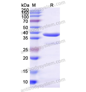 重组RBP3蛋白,Recombinant Human RBP3, N-His