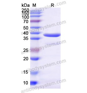 重組RBP3蛋白,Recombinant Human RBP3, N-His