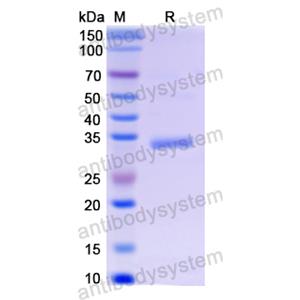 Recombinant Human NPS, N-GST