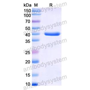 Recombinant Human H2AC11, N-GST