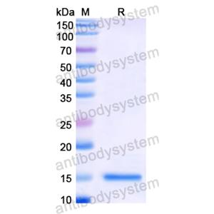 Recombinant Human OCM, N-His