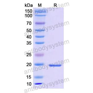 重组CALM1蛋白,Recombinant Human CALM1, N-His