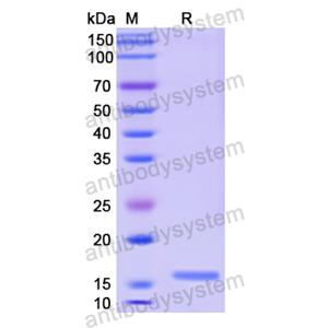 重组CALCB蛋白,Recombinant Human CALCB, N-His