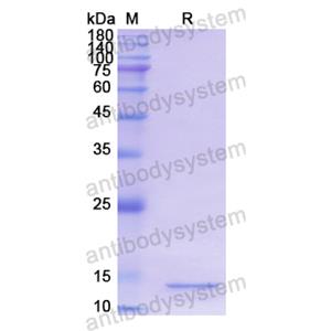 Recombinant Human MGST1, N-His