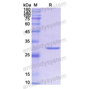 重組CYP2D6蛋白,Recombinant Human CYP2D6, N-His