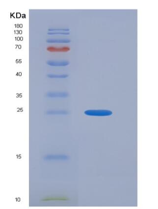 Recombinant Human A33 Protein (His Tag),Recombinant Human A33 Protein (His Tag)