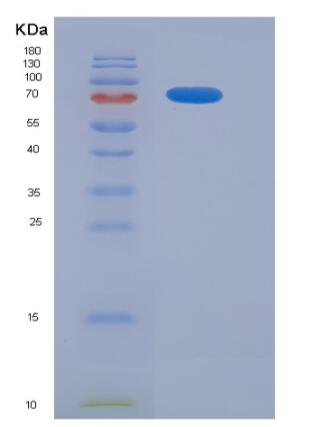 Recombinant Human CD93 / C1QR1 Protein (Fc tag),Recombinant Human CD93 / C1QR1 Protein (Fc tag)