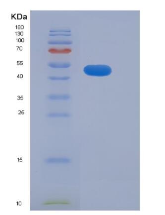 Recombinant Human ADAM15 Protein (His tag),Recombinant Human ADAM15 Protein (His tag)