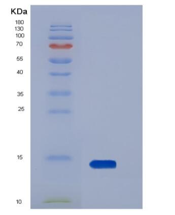 Recombinant Human AgRP / AGRP Protein (His tag),Recombinant Human AgRP / AGRP Protein (His tag)