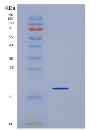 Recombinant Mouse REG3D Protein (His tag),Recombinant Mouse REG3D Protein (His tag)