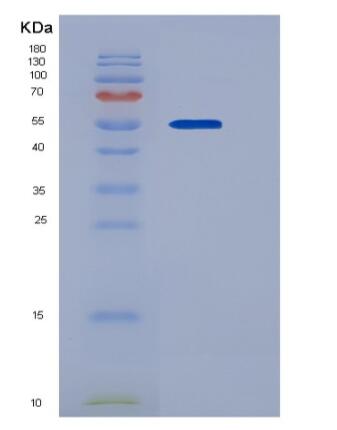 Recombinant Human ADAM15 / MDC15 Protein (His tag),Recombinant Human ADAM15 / MDC15 Protein (His tag)