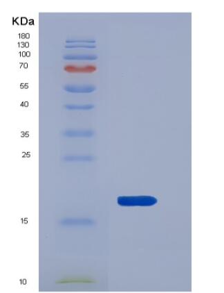 Recombinant Mouse REG3B / Pap1 Protein (His tag),Recombinant Mouse REG3B / Pap1 Protein (His tag)