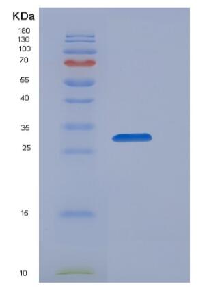 Recombinant Human OSTM1 Protein (His tag),Recombinant Human OSTM1 Protein (His tag)