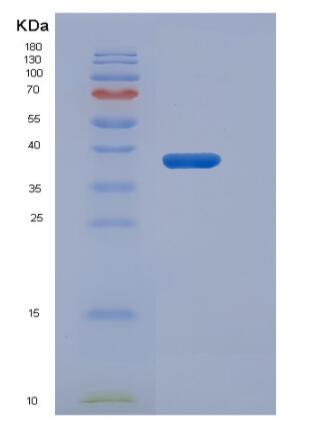 Recombinant Human MAPT / Tau Protein (His tag),Recombinant Human MAPT / Tau Protein (His tag)