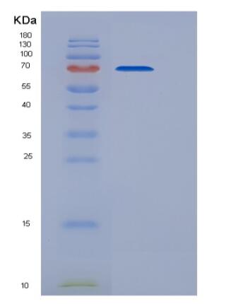Recombinant Mouse CDCP1 Protein (His tag),Recombinant Mouse CDCP1 Protein (His tag)