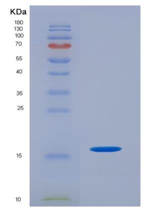 Eukaryotic T-Cell Surface Glycoprotein CD3 Epsilon (CD3e),Eukaryotic T-Cell Surface Glycoprotein CD3 Epsilon (CD3e)