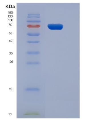 Recombinant Human CD3D & CD3E Heterodimer Protein,Recombinant Human CD3D & CD3E Heterodimer Protein