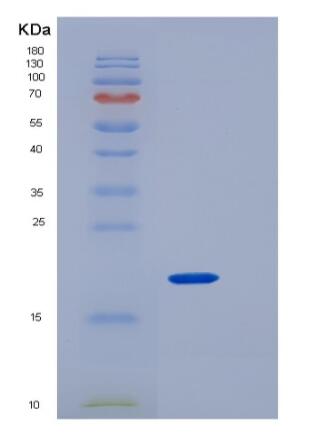 Recombinant Human CD4 / LEU3 Protein (aa 1-208, His tag),Recombinant Human CD4 / LEU3 Protein (aa 1-208, His tag)
