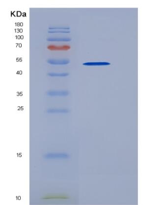 Recombinant Human CD96 Protein (His tag),Recombinant Human CD96 Protein (His tag)