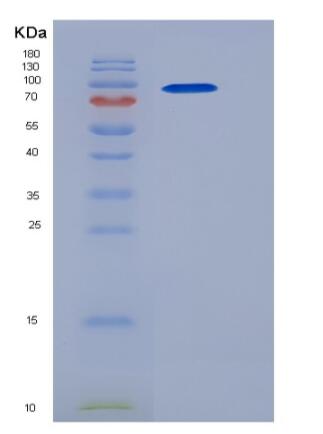 Recombinant Mouse LDLR / LDL Receptor Protein (His tag),Recombinant Mouse LDLR / LDL Receptor Protein (His tag)