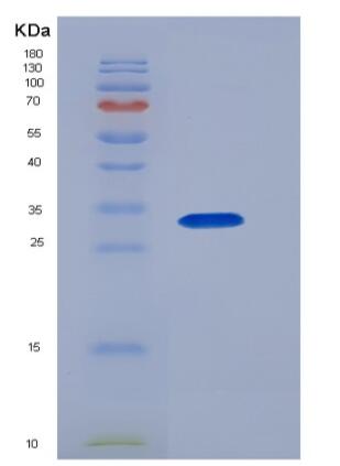 Recombinant Human CD46 Protein (His tag),Recombinant Human CD46 Protein (His tag)