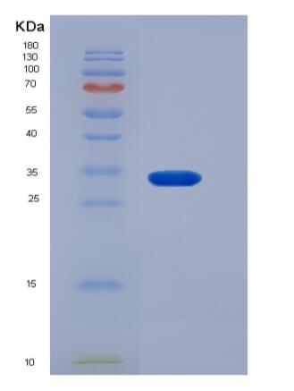 Recombinant Rat HAAO / 3-HAO Protein (His tag),Recombinant Rat HAAO / 3-HAO Protein (His tag)