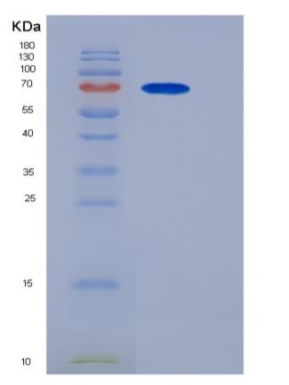 Recombinant Mouse PCSK9 / NARC1 Protein (His tag),Recombinant Mouse PCSK9 / NARC1 Protein (His tag)