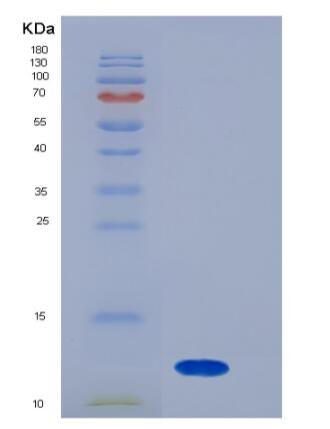 Recombinant Mouse S100A8 / CAGA Protein (His tag),Recombinant Mouse S100A8 / CAGA Protein (His tag)