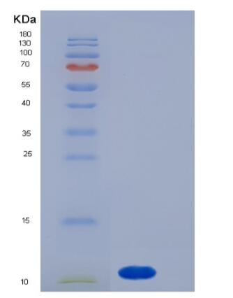 Recombinant Human S100A7 / PSOR1 Protein,Recombinant Human S100A7 / PSOR1 Protein