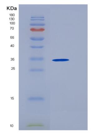 Recombinant Human Follistatin / FST Protein (His tag),Recombinant Human Follistatin / FST Protein (His tag)