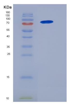 Recombinant Human NCF-2 / NCF2 / P67phox Protein (His & GST tag),Recombinant Human NCF-2 / NCF2 / P67phox Protein (His & GST tag)