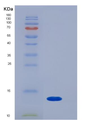 Recombinant Rat B2M / Beta-2-microglobulin Protein (His tag),Recombinant Rat B2M / Beta-2-microglobulin Protein (His tag)