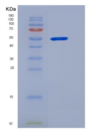 Recombinant Human PGD Protein (His Tag),Recombinant Human PGD Protein (His Tag)