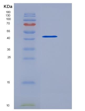 Recombinant Human CALR / Calreticulin Protein (His tag),Recombinant Human CALR / Calreticulin Protein (His tag)