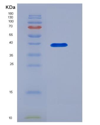 Recombinant Human DPEP2 Protein (His tag),Recombinant Human DPEP2 Protein (His tag)