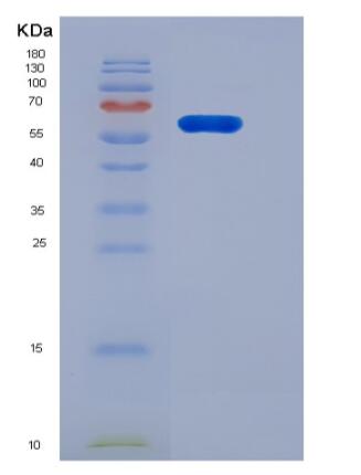 Recombinant Human PGRL / IGSF8 Protein (His tag),Recombinant Human PGRL / IGSF8 Protein (His tag)