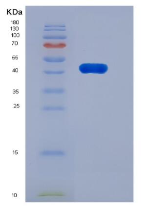 Recombinant Rat Carboxypeptidase B2 / CPB2 Protein (His Tag),Recombinant Rat Carboxypeptidase B2 / CPB2 Protein (His Tag)