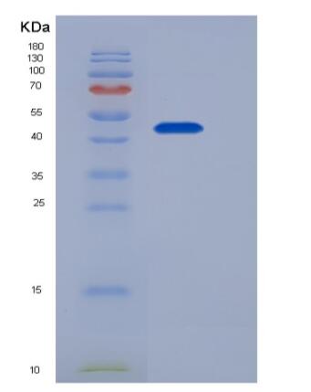 Recombinant Mouse Epcr / PROCR Protein (Fc tag),Recombinant Mouse Epcr / PROCR Protein (Fc tag)