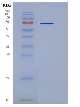 Recombinant Human CD4 / LEU3 Protein (His & Fc tag),Recombinant Human CD4 / LEU3 Protein (His & Fc tag)