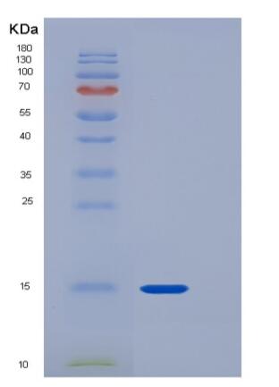 Recombinant Rat CD90 / THY-1 Protein (His tag),Recombinant Rat CD90 / THY-1 Protein (His tag)