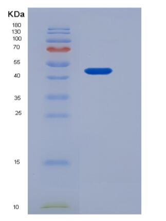 Recombinant Human AMIGO2 Protein (His tag),Recombinant Human AMIGO2 Protein (His tag)