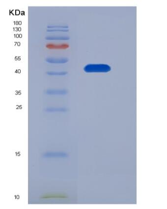 Recombinant Human FDPS Protein (His tag),Recombinant Human FDPS Protein (His tag)